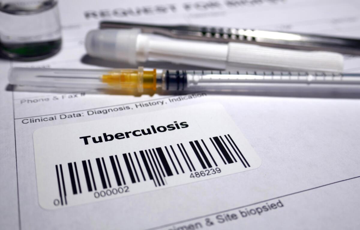 The Jackson County Department of Public Health, in coordination with the North Carolina Department of Health and Human Services, is investigating a confirmed case of tuberculosis involving an individual who spent time in Jackson County while infectious.