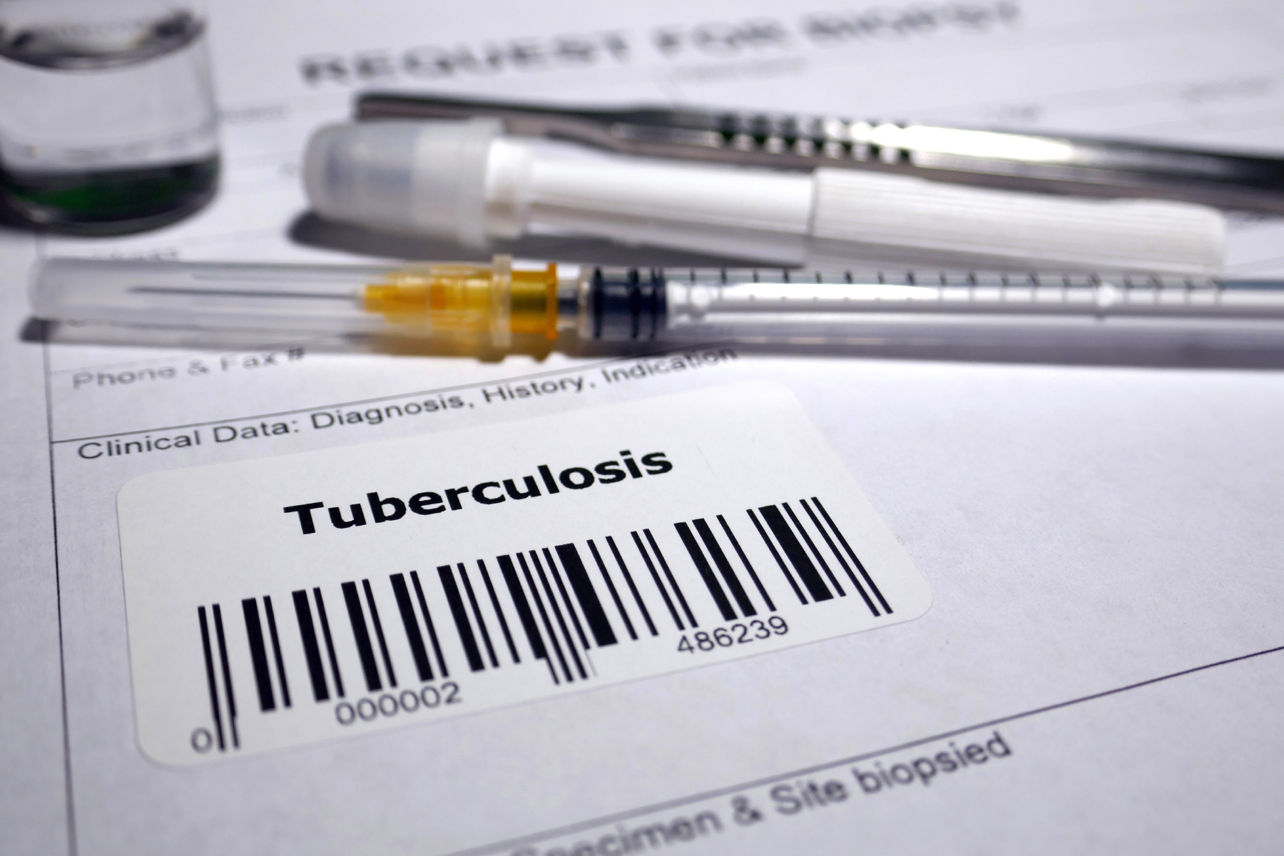 The Jackson County Department of Public Health, in coordination with the North Carolina Department of Health and Human Services, is investigating a confirmed case of tuberculosis involving an individual who spent time in Jackson County while infectious.