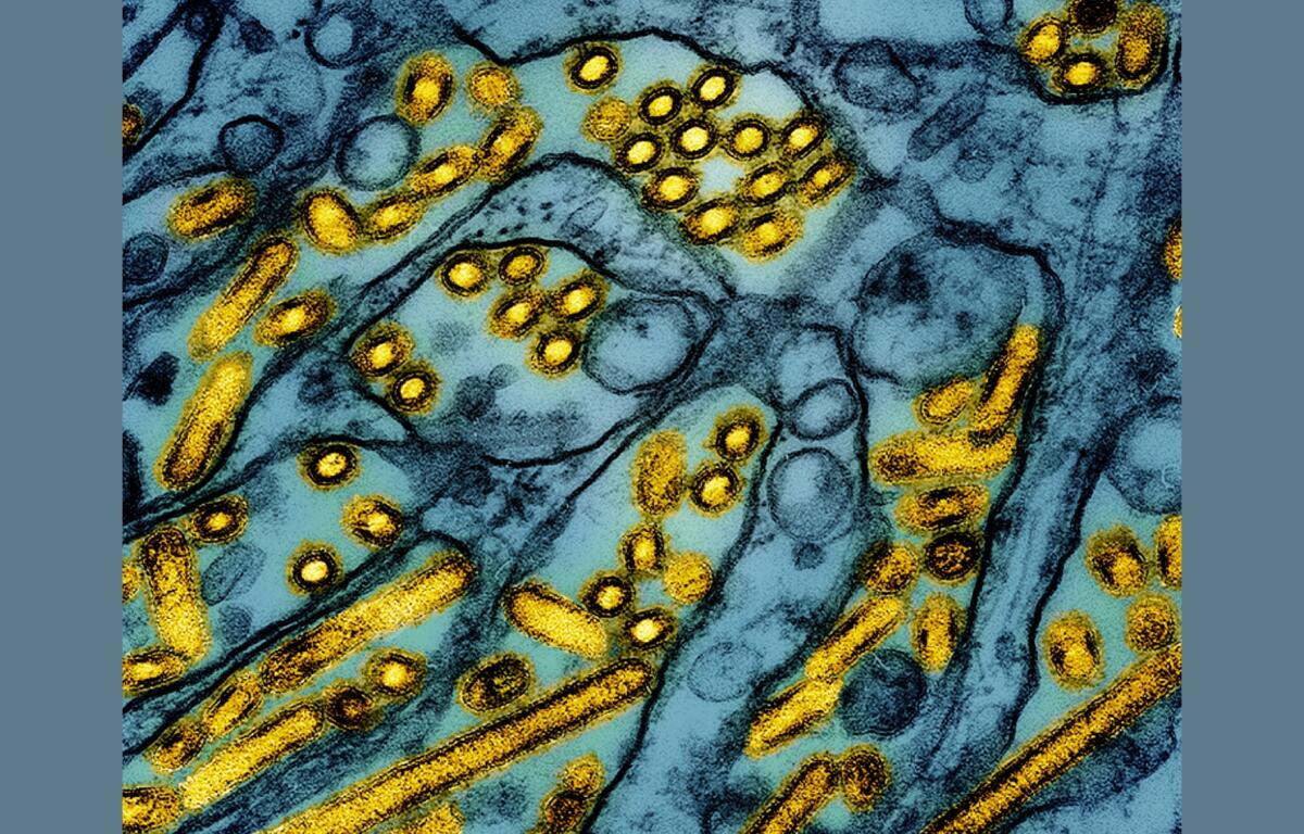 FILE - This colorized electron microscope image released by the National Institute of Allergy and Infectious Diseases on March 26, 2024, shows avian influenza A H5N1 virus particles (yellow), grown in Madin-Darby Canine Kidney (MDCK) epithelial cells (blue). (CDC/NIAID via AP, File)
