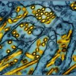 FILE - This colorized electron microscope image released by the National Institute of Allergy and Infectious Diseases on March 26, 2024, shows avian influenza A H5N1 virus particles (yellow), grown in Madin-Darby Canine Kidney (MDCK) epithelial cells (blue). (CDC/NIAID via AP, File)