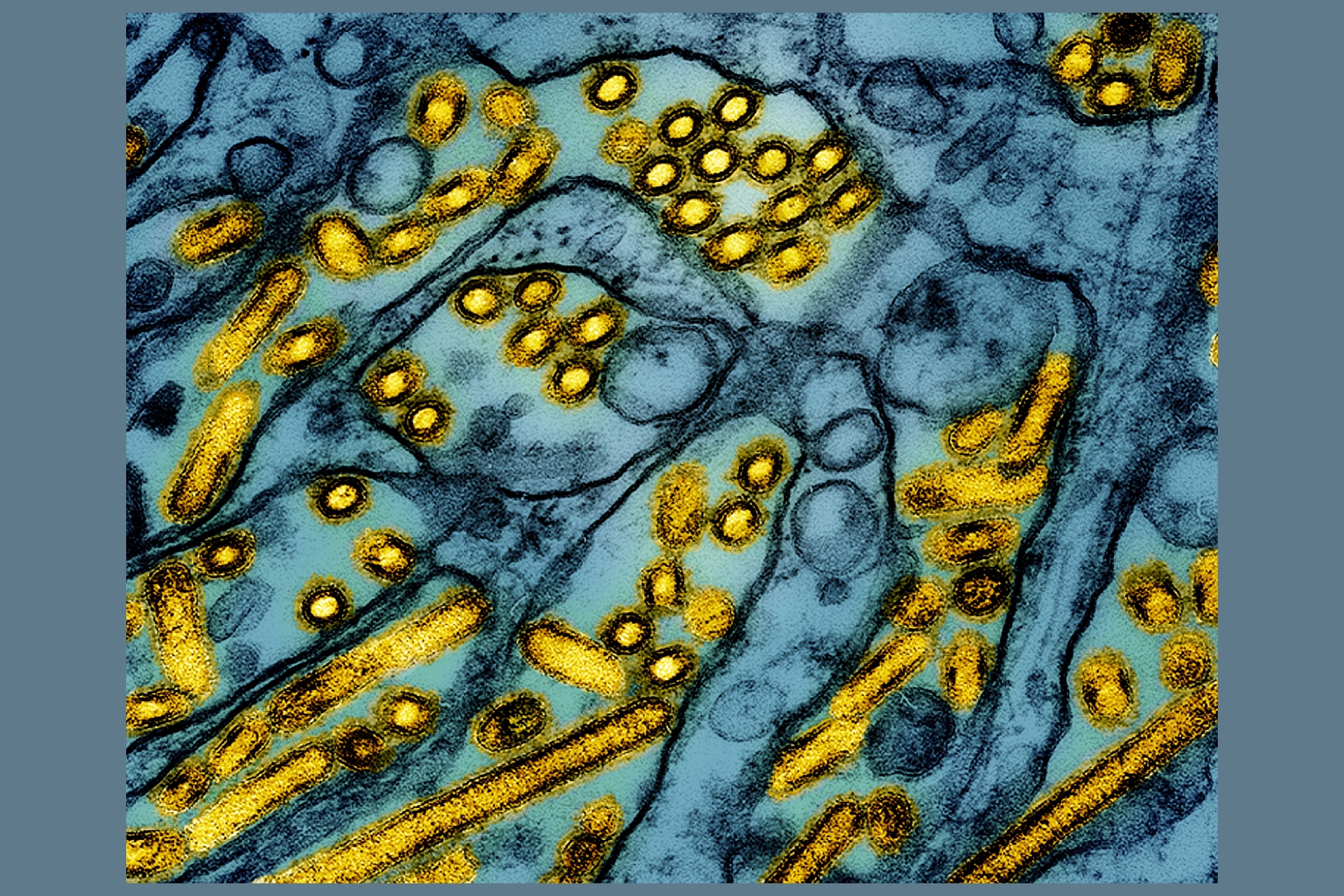 FILE - This colorized electron microscope image released by the National Institute of Allergy and Infectious Diseases on March 26, 2024, shows avian influenza A H5N1 virus particles (yellow), grown in Madin-Darby Canine Kidney (MDCK) epithelial cells (blue). (CDC/NIAID via AP, File)